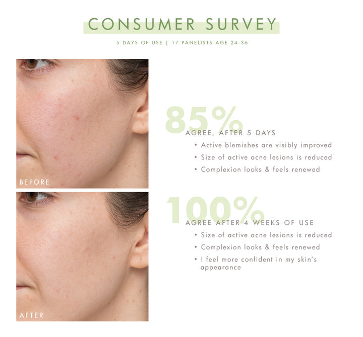 Farmhouse Fresh Comeback Clear™ Rapid Relief Acne Banishing Kit