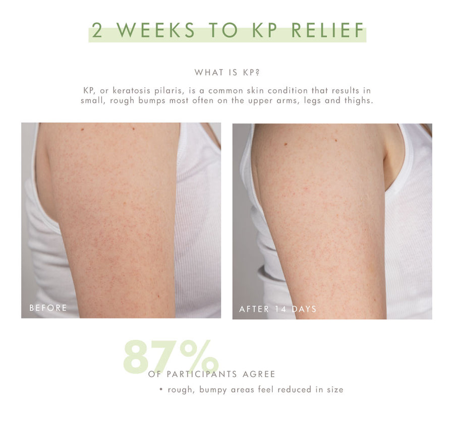 Farmhouse Fresh Smooth Reveal Resurfacing Silky Serum
